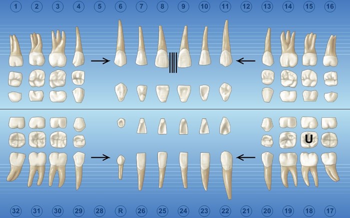 Dentrix Tooth Chart